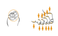 پای دیابتی 1