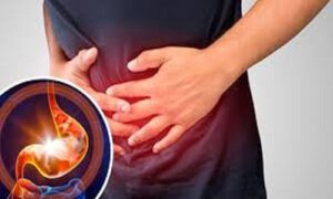 گاستریت چیست گاستریت