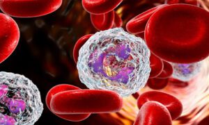 Neutropenia Neutropenia