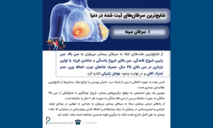 سرطان سینه ۲ سرطان سینه ۲