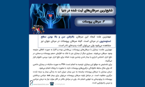Prostate cancer 2 سرطان پروستات
