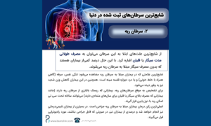lung cancer 2 سرطان ریه